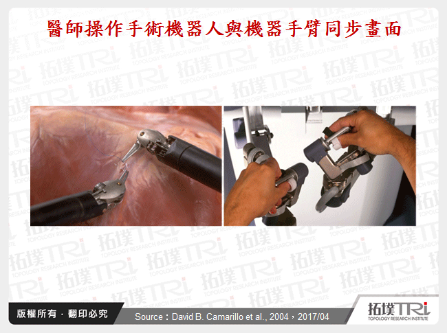醫師操作手術機器人與機器手臂同步畫面