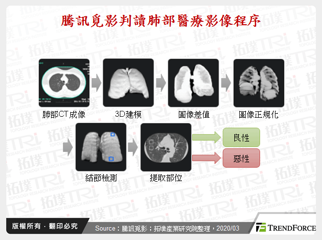 騰訊覓影判讀肺部醫療影像程序