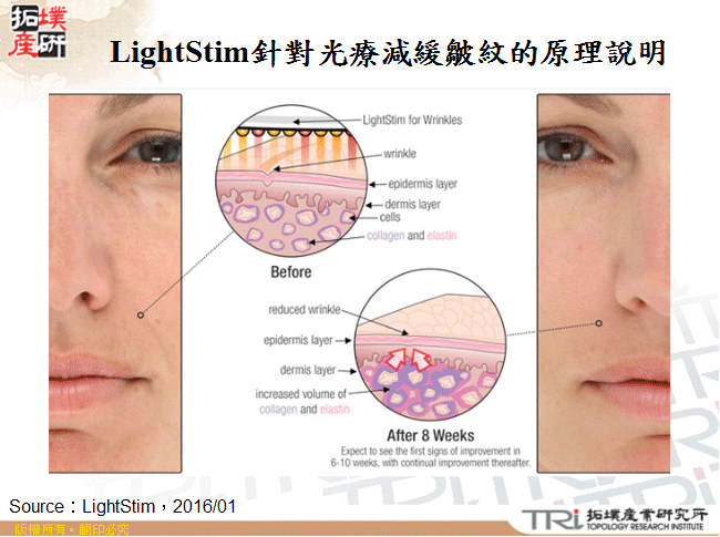 LightStim針對光療減緩皺紋的原理說明